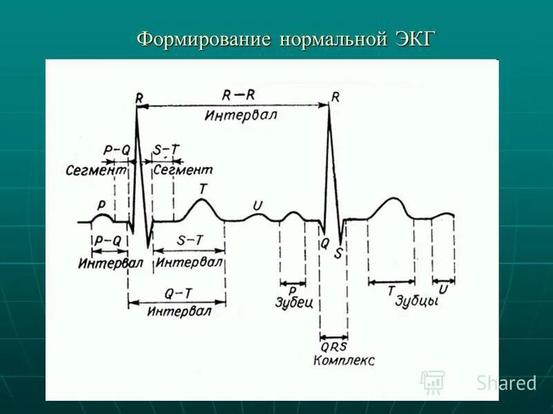 Зубцы интервалы и сегменты ЭКГ норма. Сегменты и зубцы нормальной ЭКГ. Нормальная ЭКГ формирование зубцов и интервалов. Нормальная ЭКГ зубцы сегменты интервалы. Зубцы экг в норме