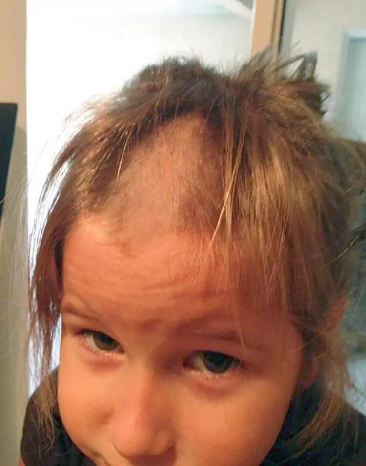 неудачные стрижки. ребенок отстриг челку. сильно подстригли волосы. сильно подстригли волосы. сильно подстригли волосы.