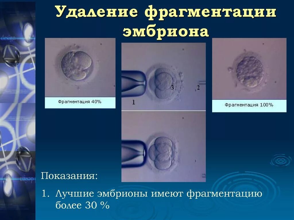 Фрагментация днк методы. Классификация качества эмбрионов. Фрагментация эмбриона. Морфология переносимых эмбрионов.