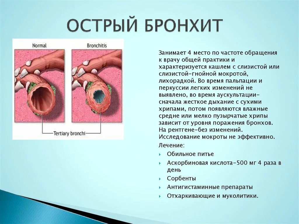 Бронхит сердца. Бронхит сообщение по биологии. Острое воспаление слизистой оболочки бронхов. Острый инфекционный бронхит.