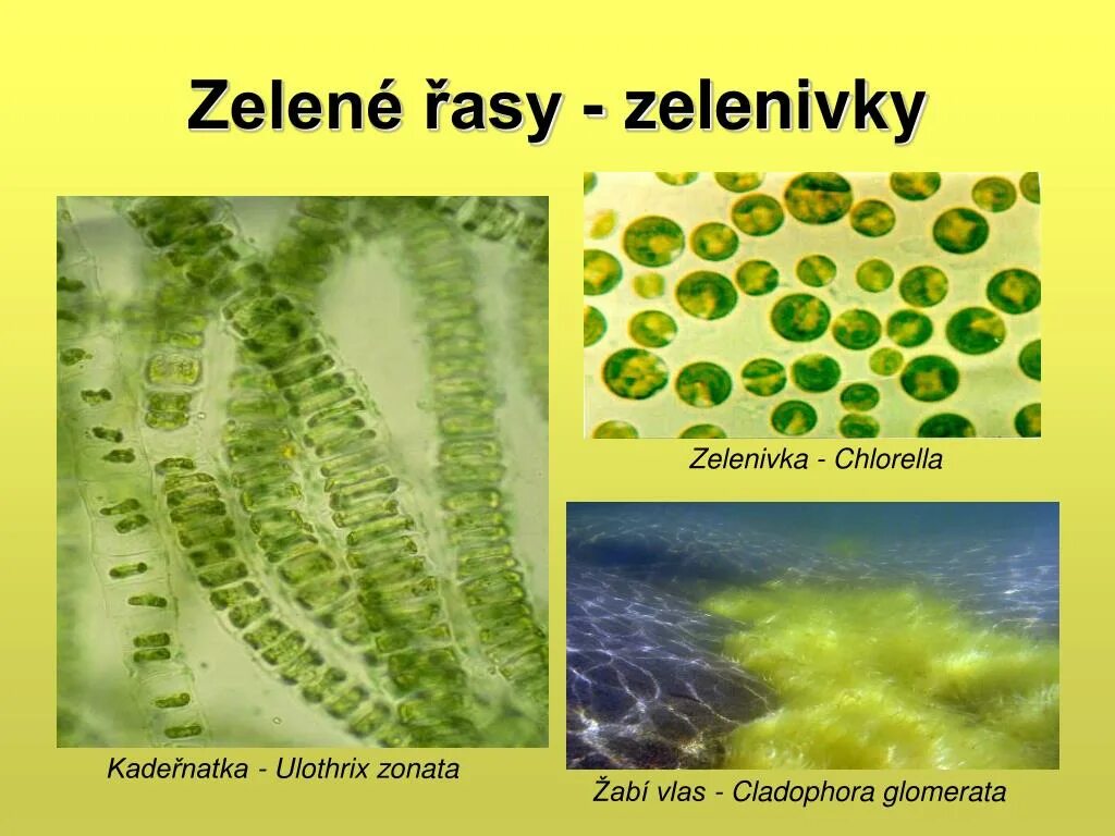 Цикл водорослей улотрикс. Хлорелла и улотрикс. Нитчатая водоросль улотрикс. Зеленые водоросли улотрикс. Улотрикс опоясанный.