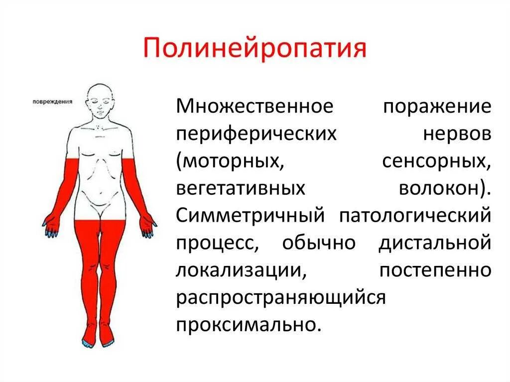 Невропатия конечностей симптомы. Диабетическая периферическая полинейропатия симптомы. Дистальные отделы нижних конечностей полинейропатия. Диабетическая дистальная сенсорная полинейропатия. Полинейропатия клиническая картина.