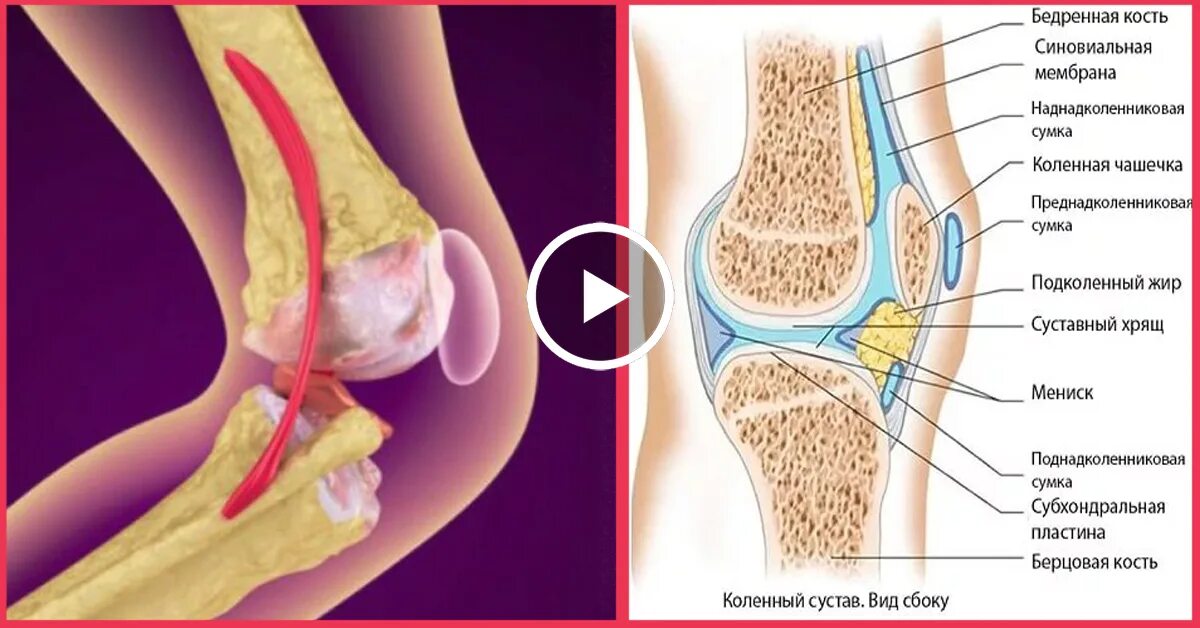 Нарушения коленного сустава. Коленный сустав. Сустав колена. Косточка в коленном суставе. Коленный сустав анатомия.