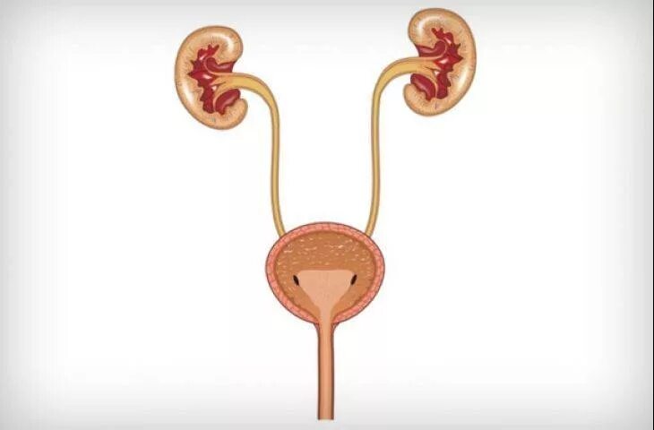 Почки мочеточники мочевой пузырь. Реимплантация мочеточника в мочевой пузырь. Мочевыделительная система заболевания. Патология мочевой системы.