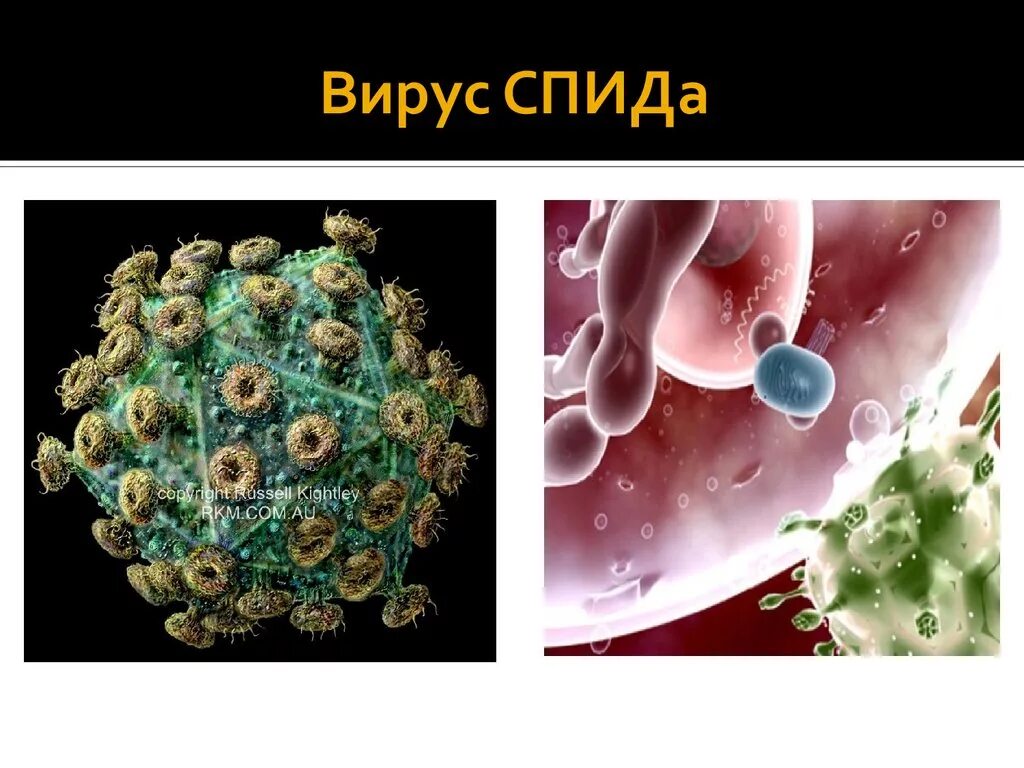 Вирус спида название. Вирус СПИДА. Вирус ВИЧ.