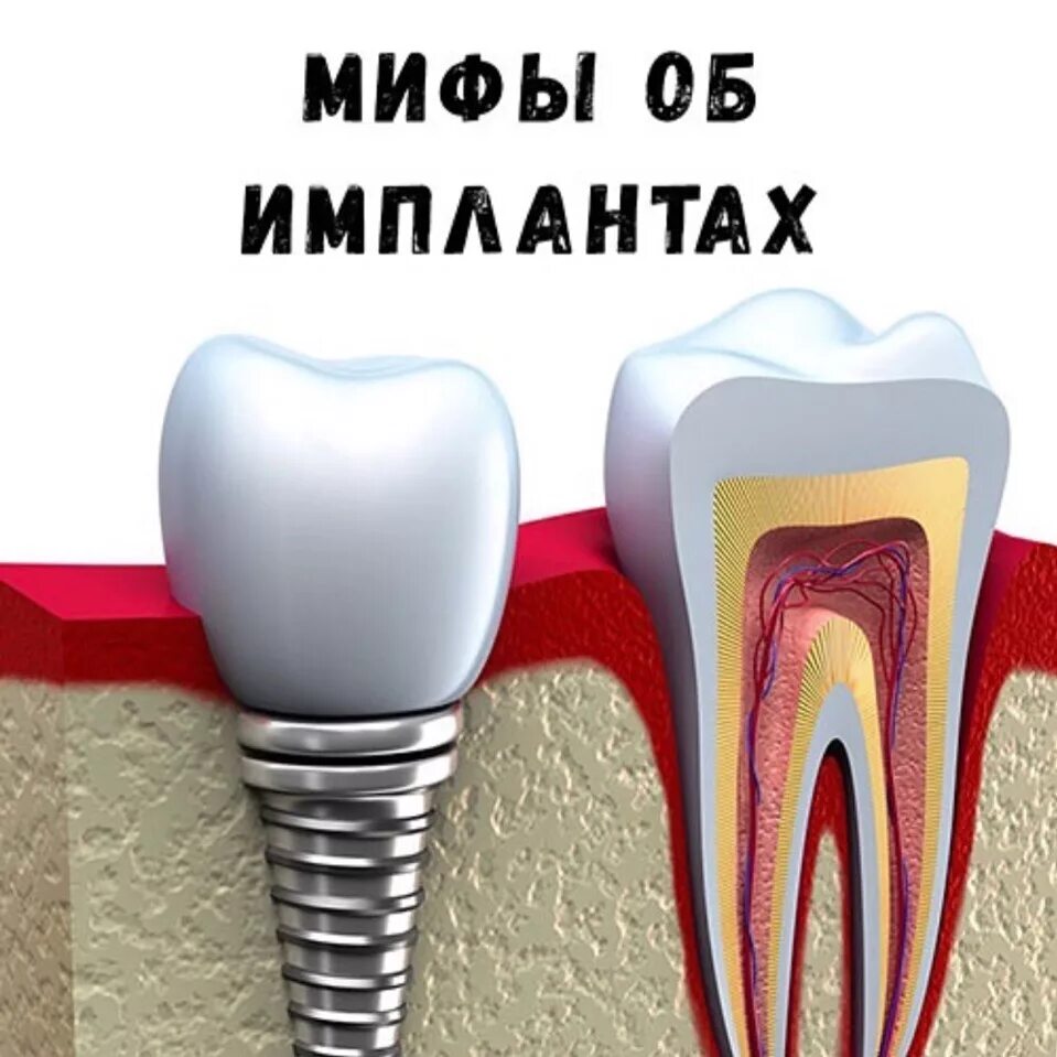 Где поставить зубы. Где поставить зубы