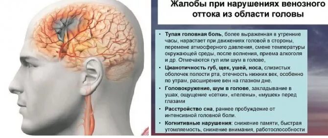 Причины сужения головного мозга. Симптомы венозной дисциркуляции головного мозга. Нарушение венозного оттока головного мозга лекарства. Нарушение венозного оттока головы. Затрудненный венозный отток головного мозга.