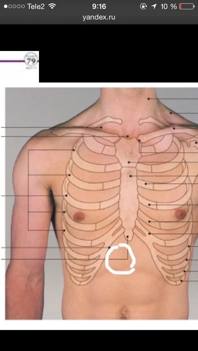 Между ребрами. Выпирает кость на грудной клетке. Выпирание ребер с левой стороны. Косточка торчит в грудной клетке.