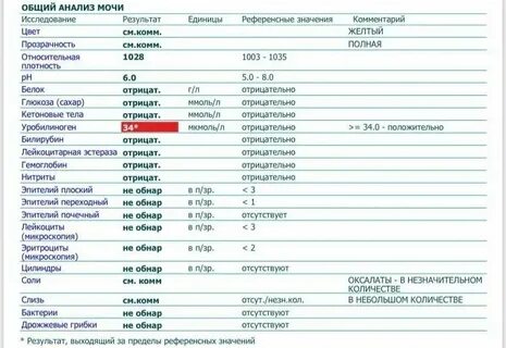Сколько мочи необходимо для общего анализа