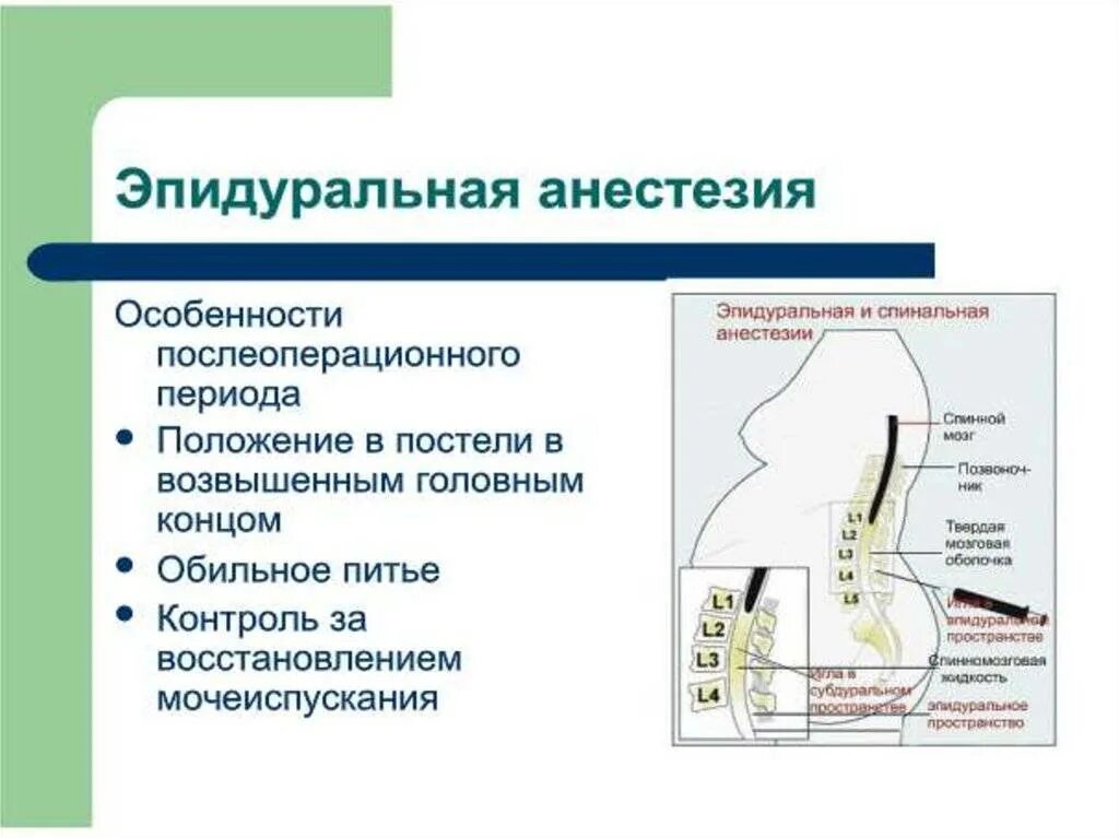 Эпидуральная спинная. Спинномозговая и перидуральная анестезия. Нейроаксиальная анестезия эпидуральная. Спинальная анестезия и эпидуральная анестезия различия. Отличие эпидуральной анестезии от спинальной анестезии.