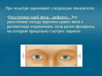 Птоз верхнего века степени