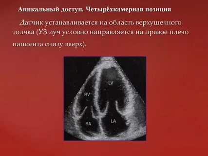 Эхо х