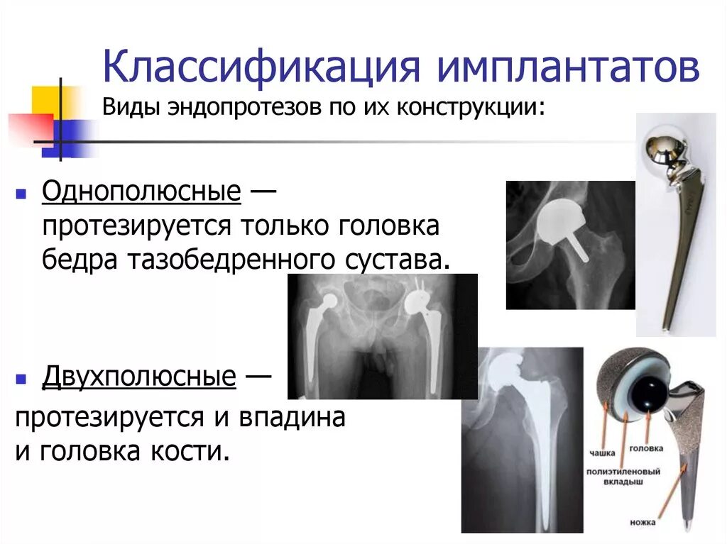 Гибридный эндопротез тазобедренного сустава. Ревизионный эндопротез тазобедренного сустава. Эндопротезирование тазобедренного сустава биполярный протез. Однополюсное эндопротезирование тазобедренного сустава.