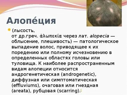 Алопеция что это такое простыми словами