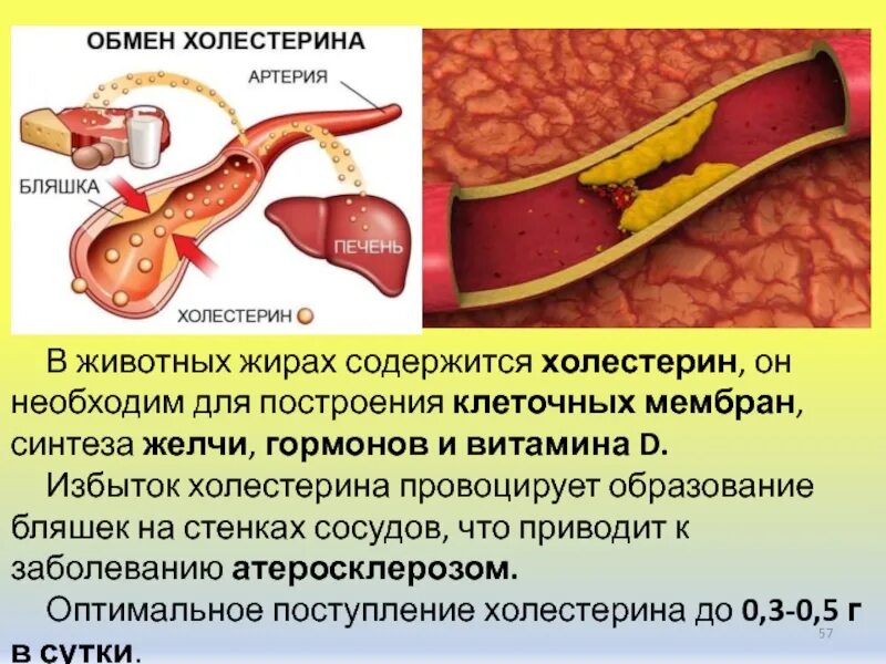 Холестерин к чему приводит