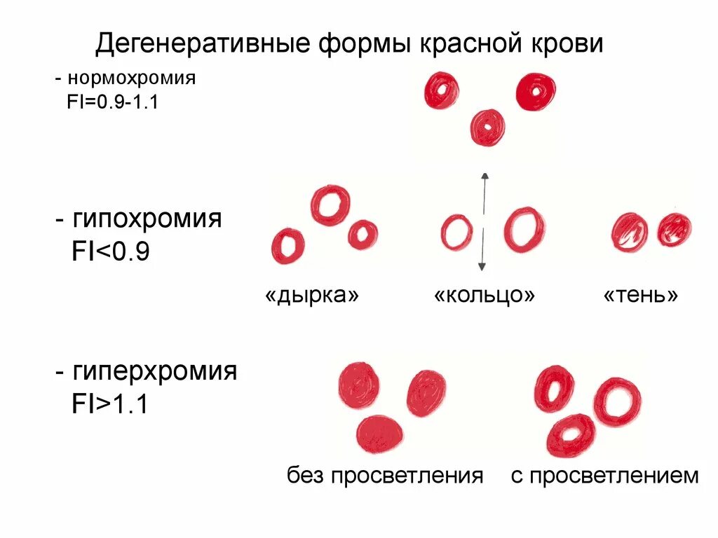 Нормохромная гипохромная анемия. Гипохромная анемия показатели. Нормохромная гипохромная гиперхромная анемия. Гиперхромия эритроцитов в крови. Гипохромные нормохромные гиперхромные эритроциты.