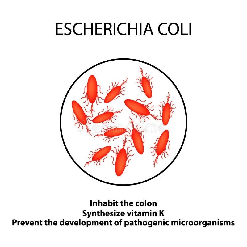 Escherichia coli 10 6 в мазке у ребенка. Симптомы при кишечной палочке. Мазок и бак посев отделяемого уретры. Форма бактерии escherichia coli. Норма кишечной палочки в моче у детей.