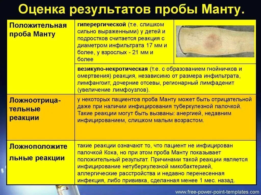 Положительный результат пробы. Результаты пробы манту и оценка результатов. Проба манту оценка результата туберкулеза. Норма прививки реакция манту. Показатели пробы манту у детей.