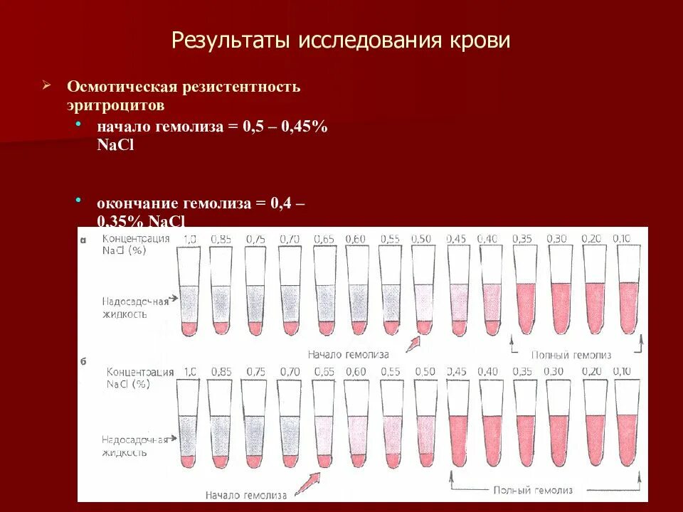 Метод изучения эритроцитов. Методика исследования осмотической стойкости эритроцитов. норма осмотической стойкости эритроцитов. измерение осмотической устойчивости эритроцитов. исследование осмотической резистентности эритроцитов норма.