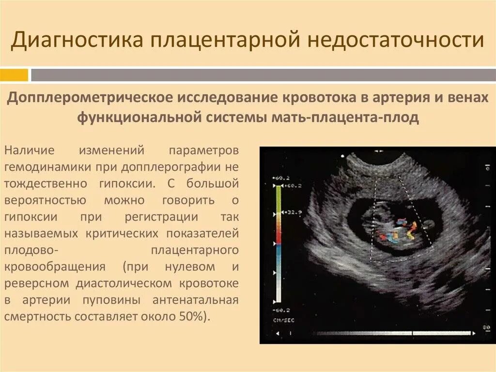 Плодово плацентарное нарушение. УЗИ признаки плацентарной недостаточности. Преждевременная отслойка плаценты УЗИ. УЗИ при отслойке плаценты.