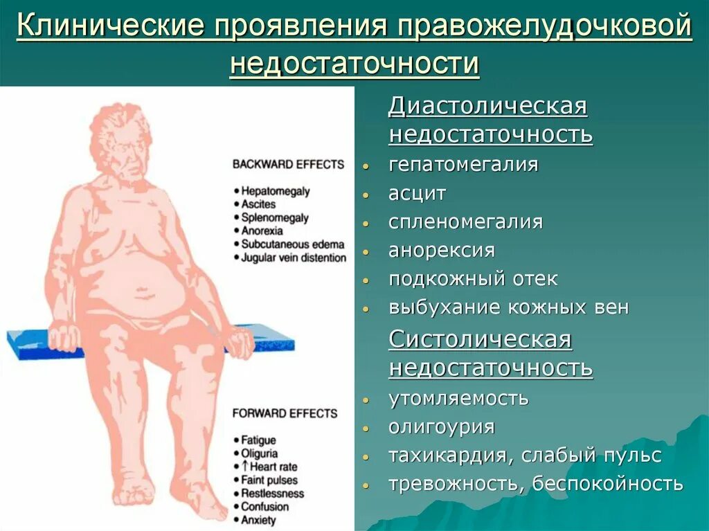 Клинические проявления правожелудочковой сердечной недостаточности. Клинические признаки правожелудочковой недостаточности симптом. Больные с сердечной недостаточностью. Клинические проявления ХСН.