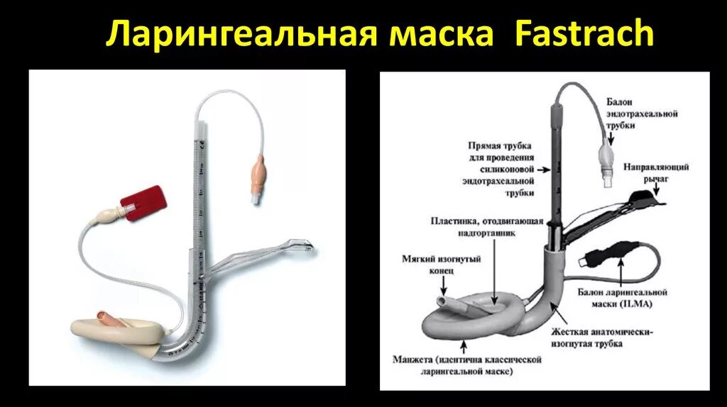 Размеры ларингеальных масок. Ларингеальная маска 6с манжетой. Ларинготрахеальная трубка техника. Ларингеальная трубка и интубационная трубка. Ларингеальная трубка - надгортанный воздуховод.