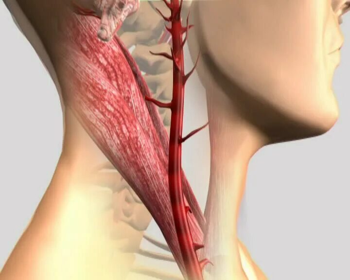 Сонные артерии на шее человека фото. Операция каротидная эндартерэктомия.