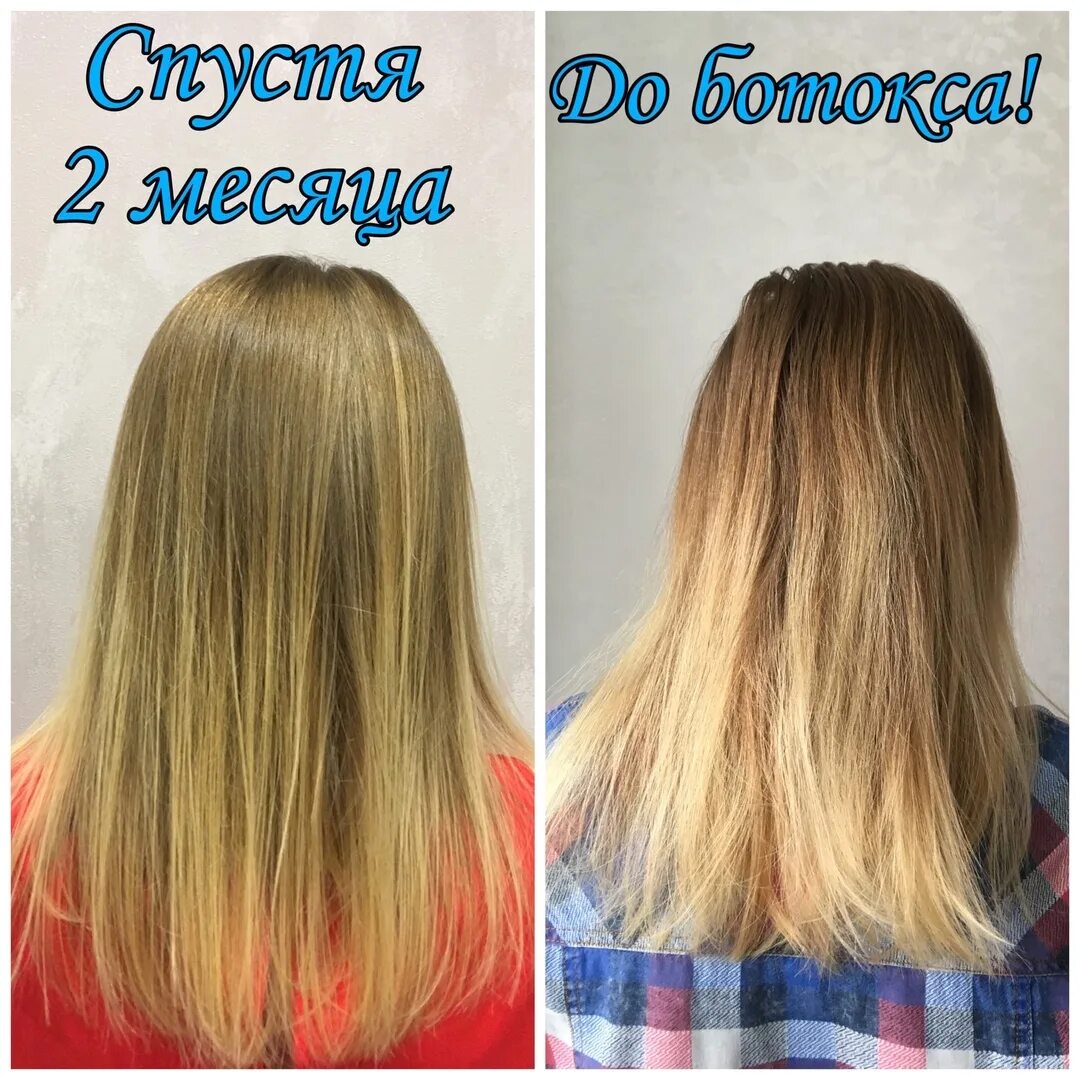 Можно ли мыть голову после ботокса