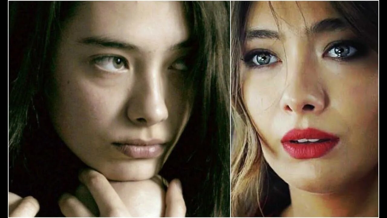 неслихан атагюль без пластики. неслихан до и после пластики. неслихан атагюль пластика до и после. неслихан до и после пластики. неслихан атагюль нос.