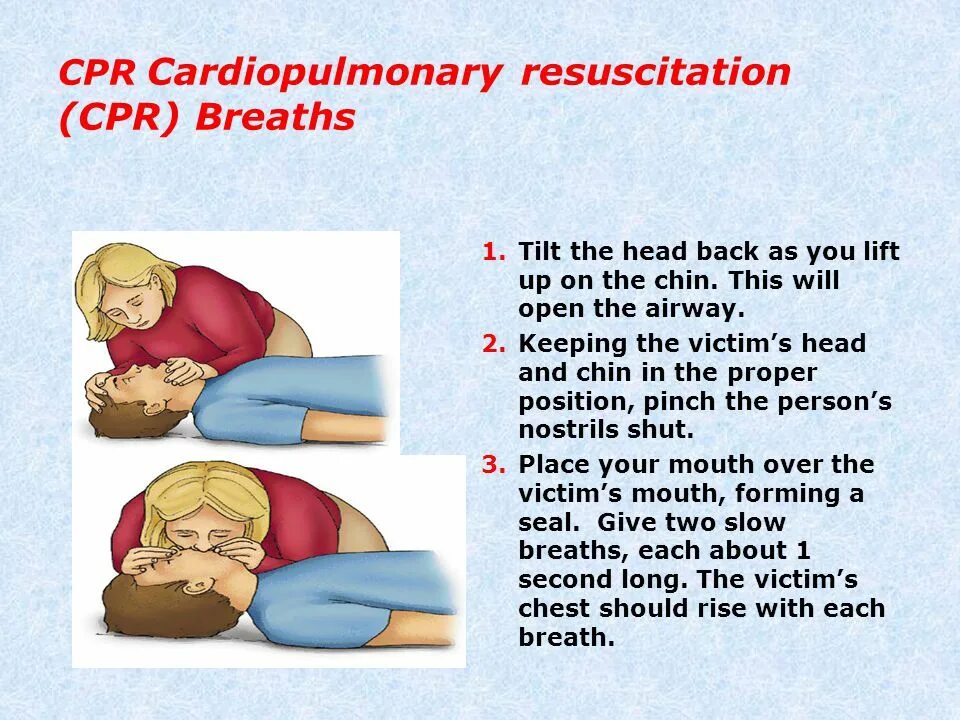 CPR prone position Cardiopulmonary Resuscitation.