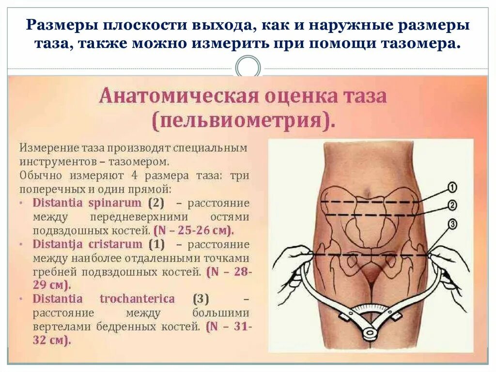 Алгоритм таз. Измерение наружных размеров большого таза алгоритм. измерение наружных размеров таза пельвиометрия алгоритм. наружная пельвиометрия в акушерстве. анатомическая оценка таза акушерство.