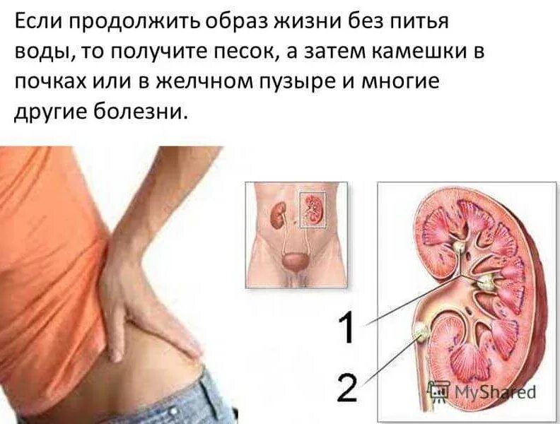 Признаки песка. Признаки песка