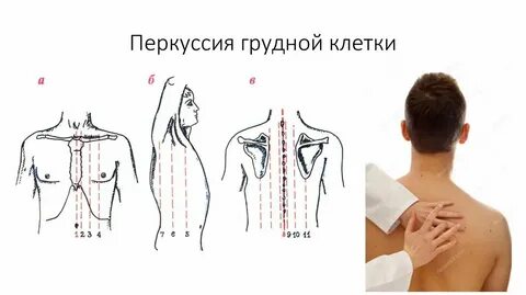 Перкуссия органов дыхания
