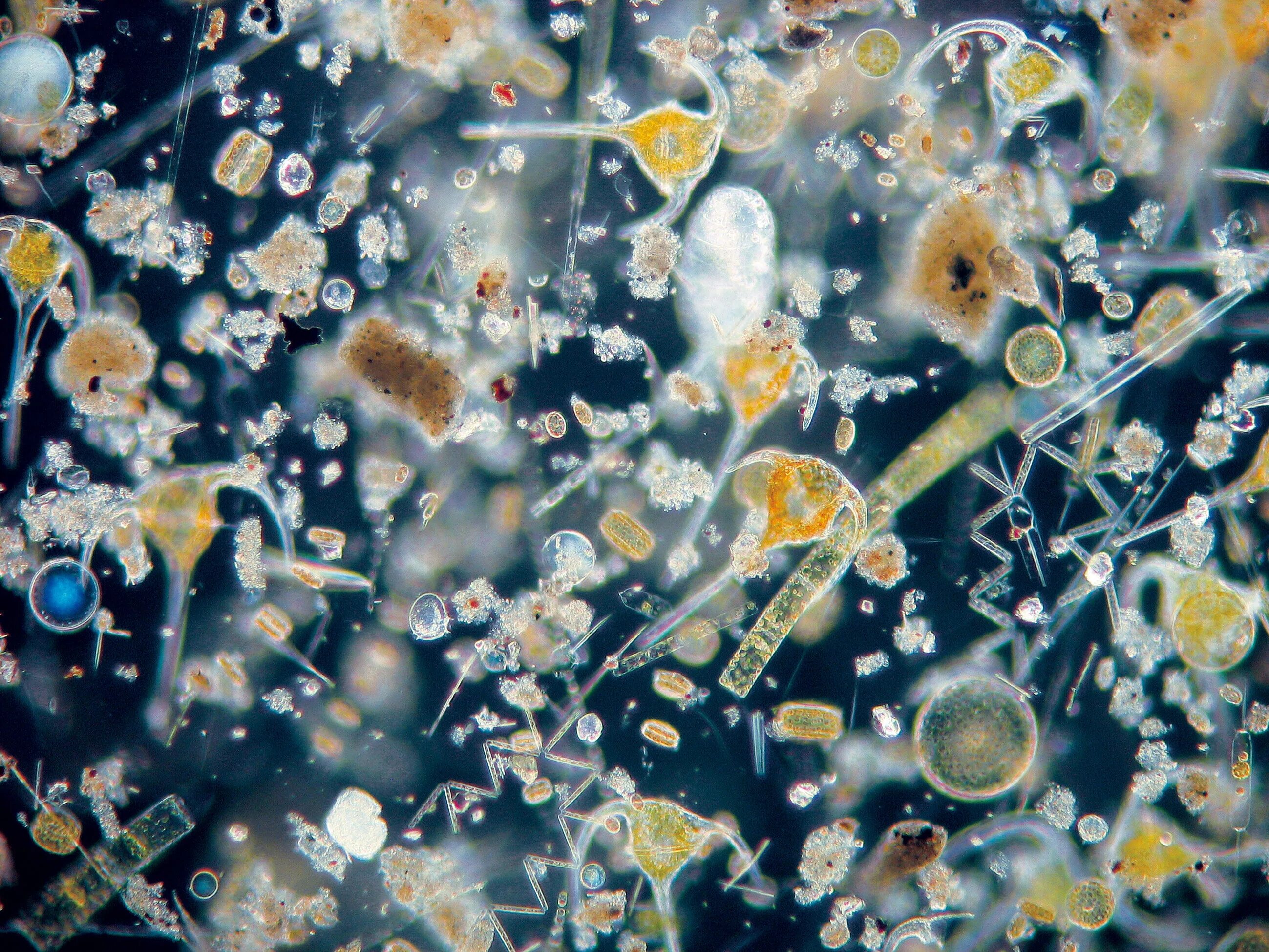 Бактерии в питьевой воде. Водопроводная вода под микроскопом. Водопроводная вода под микроскопо. Морская вода под микроскопом. Микроорганизмы в воде под микроскопом.