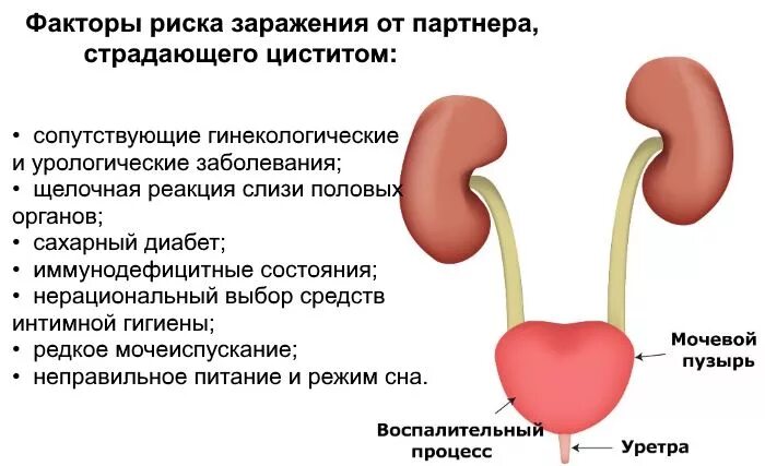 Можно греть мочевой. Передается ли цистит половым путем.