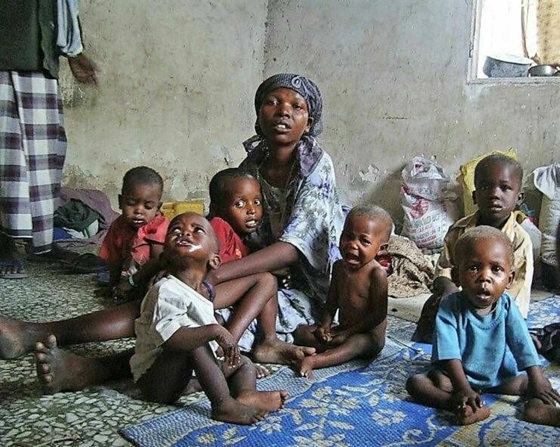 Голод страны. Голодающие дети Африки 2018. Голодающие дети Сомали. Голодные дети Африки Африки бедные.