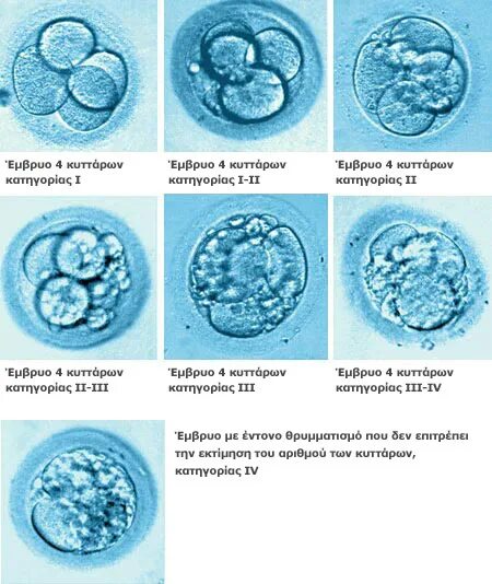 Эмбрион после пересадки. Эмбрион при эко 4аа. Классификация эмбриона 4аа. Бластоциста 3вв. Эмбрион бластоциста 2ab.