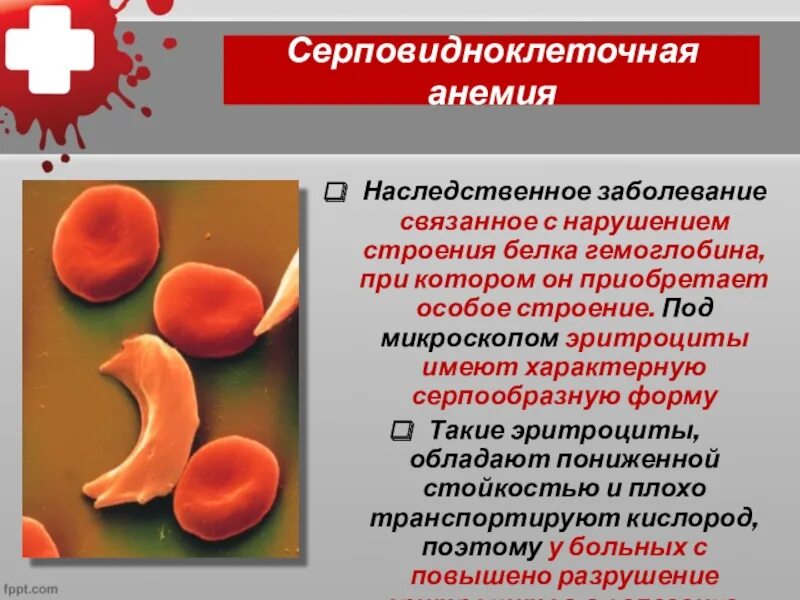 Печень образование эритроцитов. Серповидная клеточная анемия причины. Гемоглобин s при серповидноклеточной анемии. Синдром серповидноклеточной анемии причины. Серповидноклеточная анемия клинические проявления.