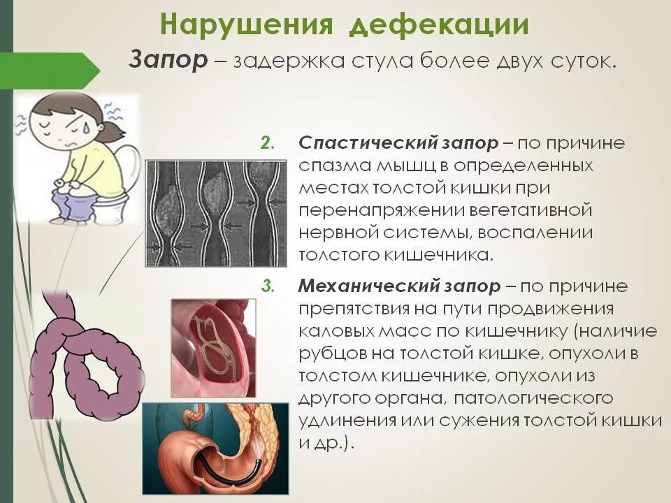 Причины запора. Спастический запор. Спастический запор причины.