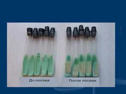 Микобактерии туберкулеза питательные среды
