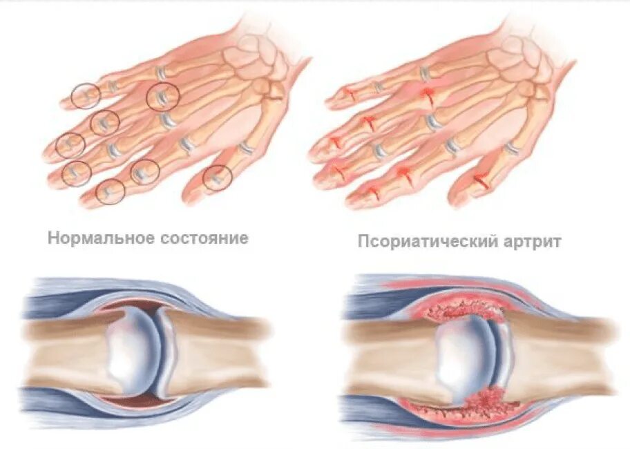 Болит основание большого пальца