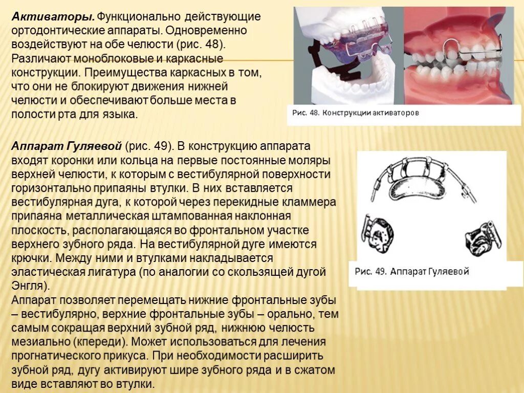 Активатор виды. Аппараты активаторы в ортодонтии. Функциональные ортодонтические аппараты. Механические ортодонтические аппараты. Лечебные аппараты в ортодонтии.