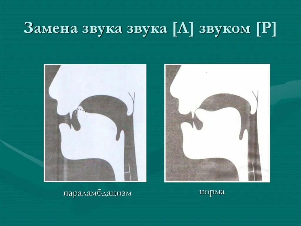 Профиль буквы р