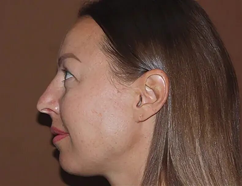 Усольцева наталья юрьевна екб. Ничкова ольга юрьевна пластический хирург отзывы. Ничкова ольга юрьевна пластический хирург работы фото. Ничкова пластический хирург. Ничкова пластический хирург.