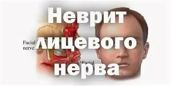 Лицевой нерв мкб