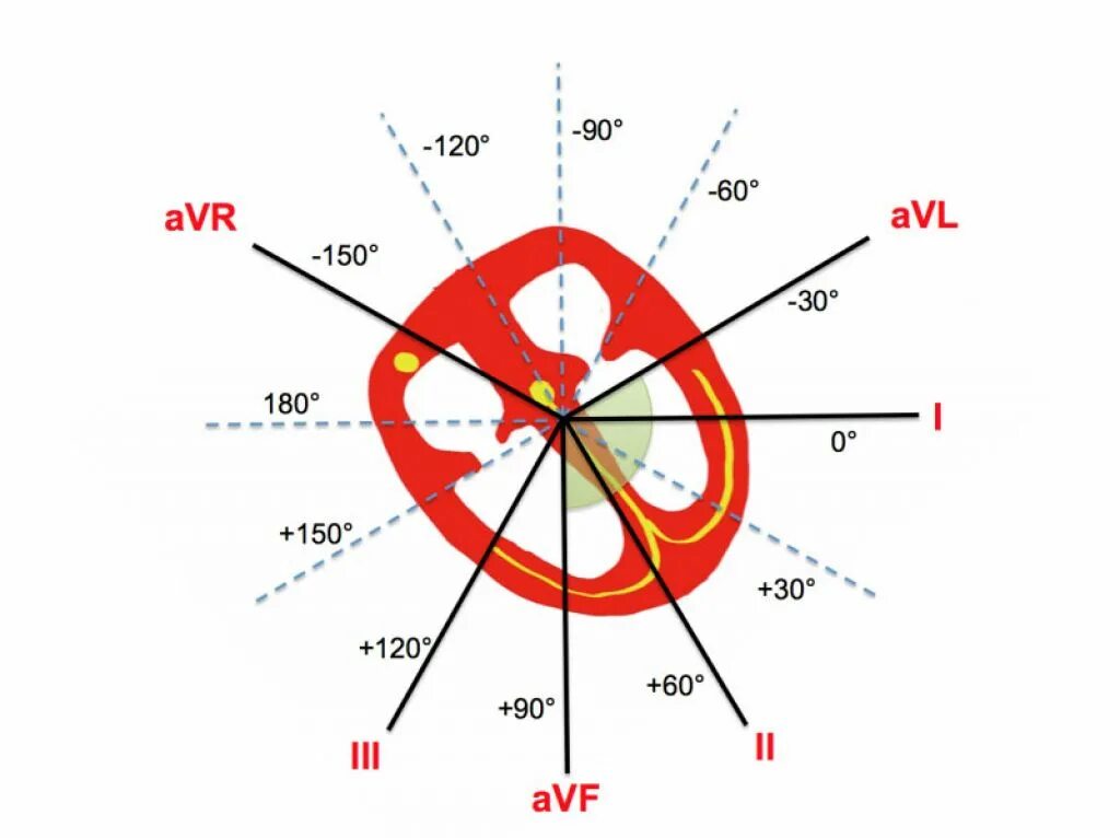 Диаграмма для определения электрической оси сердца. Электрическая ось сердца на ЭКГ -60 градусов. Электрическая ось сердца норма. Положение оси сердца косое. 60 электрических градусов