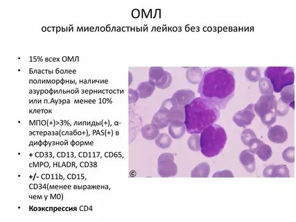 Миелобластный лейкоз клинические рекомендации