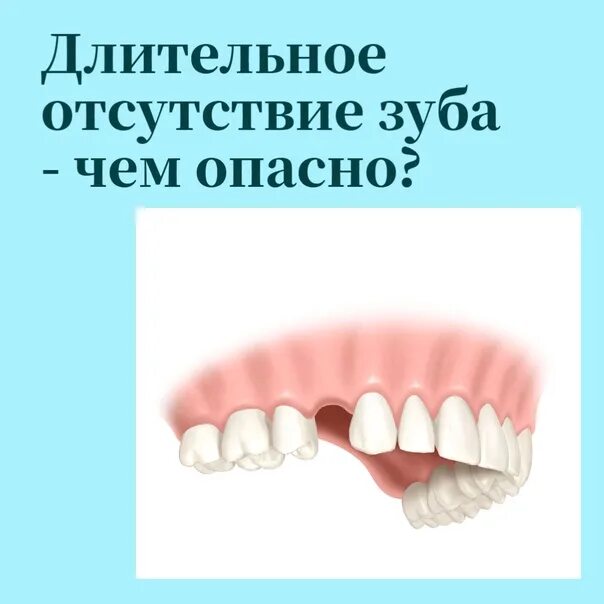 Длительное отсутствие зуба чем. Чем опасно длительное отсутствие зуба. Долгое отсутствия зуба последствия.
