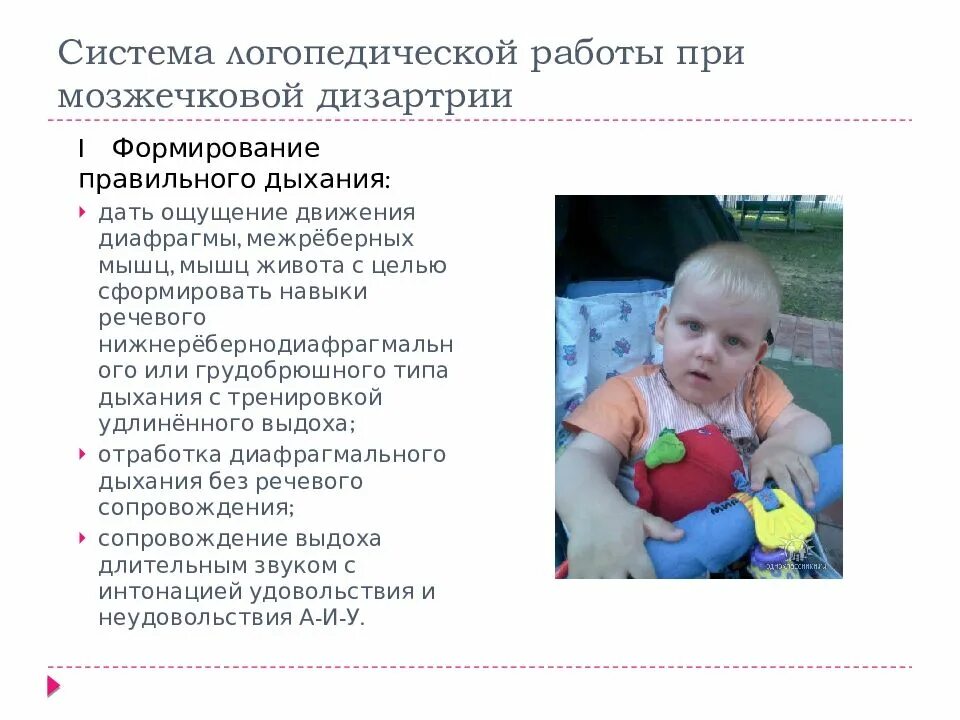 Направления работы с детьми с дцп. Особенности логопедической работы при дцп. при мозжечковой дизартрии. упражнения для восстановления речи при мозжечковой дизартрии. дизартрия дцп.