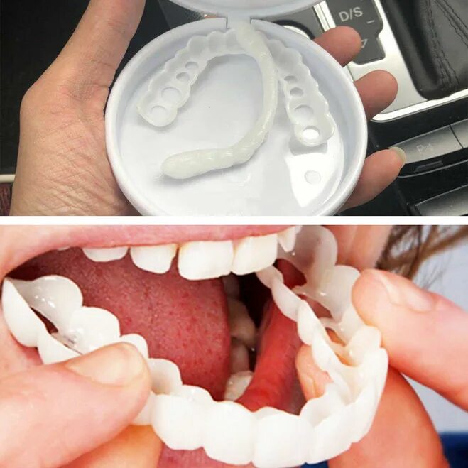 Как использовать виниры. Виниры snap on smile. съемные виниры snap-on smile. виниры для зубов snapon smile (белый). элайнеры snap on smile.